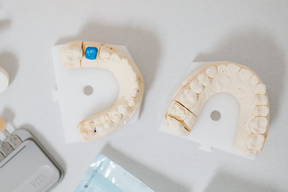 Coronas de Zirconio: Innovación en Odontología Forense